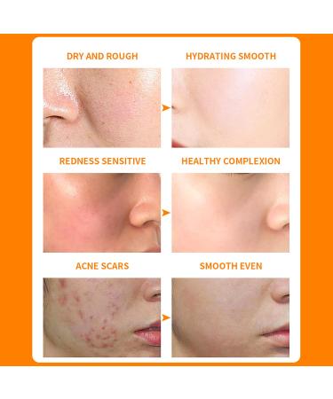 Vitamin C Collagen Moisturizing Gel with Orange Extract | After Sun Repair Soothes & Refines Pores | 300g - Anti-Oxidation Skincare - Buy Online on GoSupps.com