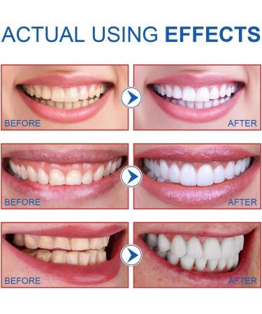 2Pcs Easilyous Bright White Toothpaste Intensive White Toothpastes Freshening Breath Removal Tooth Stains (2PC) - Buy Online on GoSupps.com