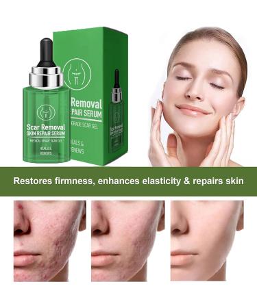 Scar Removal & Skin Repair Serum | Advanced Complex for C-Section, Surgery, Burn, Keloid & Acne | 2 Bottles - Buy Online on GoSupps.com