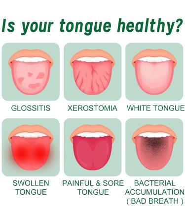 Buy Tongue Repair Spray Set (3 x 30ml) - Reduce Swelling & Freshen Breath | Effective Tongue Relief Treatment - Buy Online on GoSupps.com