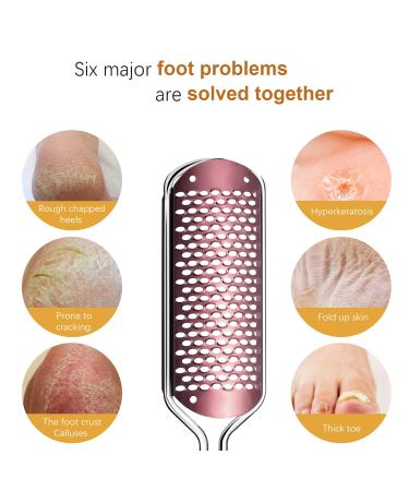 Effective Corn Skin Remover for Feet | Cornhauting Horn Skin Treatment - International Shipping Available - Buy Online on GoSupps.com