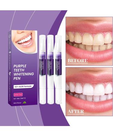 Purple Toothpaste Whitening Gel Pen Teeth Whitening Gel Pen Purple Toothpaste Whitening Gel Pen Purple Toothpaste Whitening Whiten Teeth Easily Effective & Painless - Buy Online on GoSupps.com