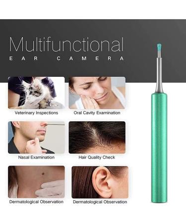 Feilx Ear Wax Removal Ear Cleaner with Camera HD Endoscope Earwax Remover Tool Wireless Ear Otoscope Ear Cleaning Tool for Kids Adults (Color : C) - Buy Online on GoSupps.com