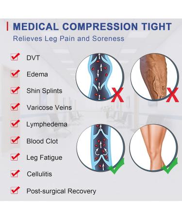 Beister Medical Compression Stockings for Women & Men - 20-30 mmHg Opaque Toe-Free Support Pants for Varicose Veins & Edema - Brown XXL - Buy Online on GoSupps.com