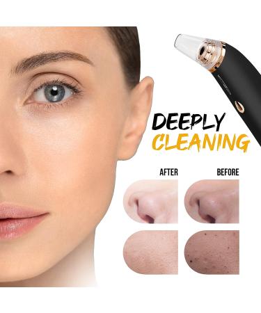 TOONZIB Rechargeable Blackhead Remover Vacuum with 4 Suction Heads & Mud Mask for All Skin Types - Buy Online on GoSupps.com