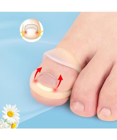 10 Pcs Toe Nail Corrector Ring Stretch Resistant Silicone Brace for Ingrown Toenails Transparent Reusable Design - Buy Online on GoSupps.com