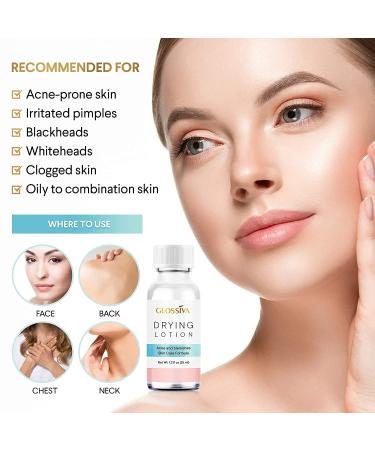 Glossiva Drying Lotion - Overnight Acne Spot Treatment for Pimples & Blemishes (1.23 Fl Oz) - Buy Online on GoSupps.com