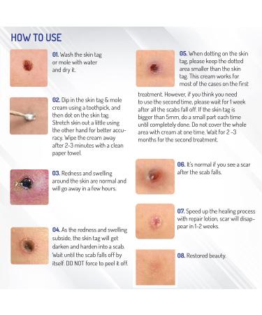 Mole Removal & Skin Tag Repair Gel Set - Remove Effectively at Home - Buy Online on GoSupps.com