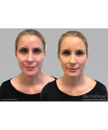 Dermaflage Waterproof Concealer Cream - Full Coverage Makeup (Golden Fair 6g) - Buy Online on GoSupps.com
