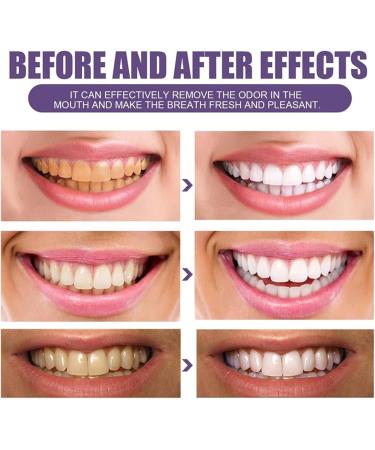 3 Days Tooth Powder Purple Teeth Cleaning Powder 3 In 1 Natural Pearl Probiotic Tooth Powder Instant Glowing Teeth Powder with Mint Refreshing Taste Reduce Stains and Yellow Effectively (1pc) 1.76 Ounce (Pack of 1) - Buy Online on GoSupps.com