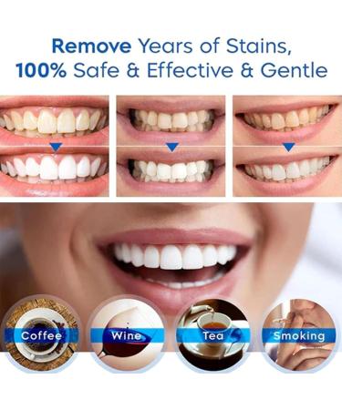 QDHGCFOC Timeless Vanilla Teeth Whitening Pen Teeth Whitening Pen Instant Teeth Whitening Pen Teeth Whitening Essence for Sensitive Teeth - Buy Online on GoSupps.com