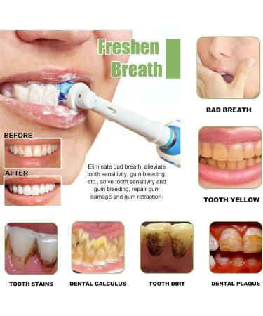 HydroxyapatiteToothpastes 7.5% hydroxyapatite Toothpaste for Enamel Protection and Tooth Strengthening Gentle Mint Fresh Breath Daily Use for Oral Health(2pcs) 2pcs 0 Fl Oz (Pack of 3947) - Buy Online on GoSupps.com