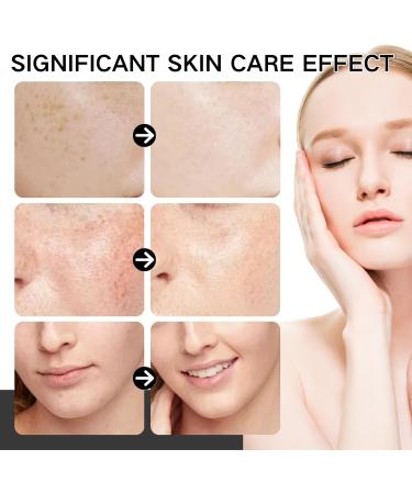 Face Serum for Women - Niacinamide Serum - Face Serum - Dark Spot Correcting Glow serum - Hydrating Serum - Bee Venom Face Care Brightening Serum Blackhead Remover Skincare - Buy Online on GoSupps.com