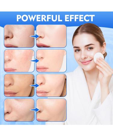 Glycolic Acid Pads Dual-Sided Facial Exfoliating Pads with Glycolic Acid & Niacinamide to Reduce Wrinkles Deep Clean Pores and Brighten Skin for All Skin Types 60 Count - Buy Online on GoSupps.com