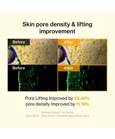 Banatinol Slow aging Ampoule 30 ml Korean Skincare Retinol Serum For Face 1.01 Fl Oz - Buy Online on GoSupps.com