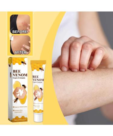 Vitiligo Bee Venom Treatment Cream | Effective Bee Venom Therapy for Skin Rejuvenation - Buy Online on GoSupps.com