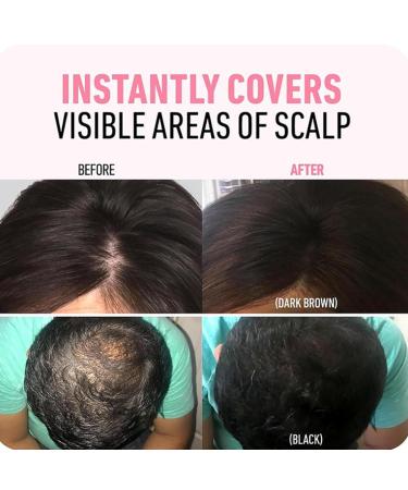 Waverloo Magic Root Cover Up - Blonde Hair Powder Hairline Touch Up Root Cover Up Powder for Women - International Shipping Available - Buy Online on GoSupps.com