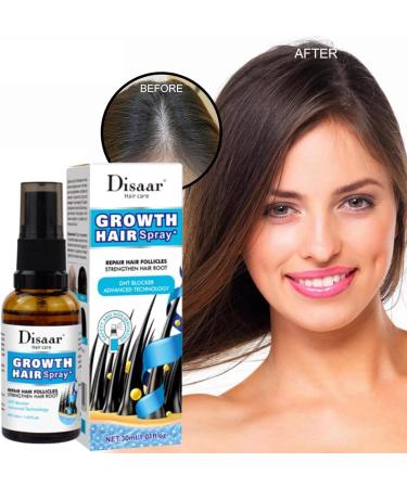 30ml Hair Growth for Women | Hair Thickening Spray for Thin Hair - Keeps Hair Regrowth for Men and Women Hair for Men Women Thinning Repair Care - Buy Online on GoSupps.com