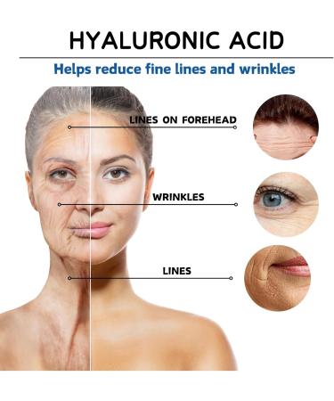 Hyaluronic Acid Microneedling Serum - Hyaluronic Acid Face Serum - Gla-Mory Micro-Infusion Facial System - Hyaluronic Acid Serum for Face - Dark Spot Remover for Face - Face Serum for Women - Buy Online on GoSupps.com