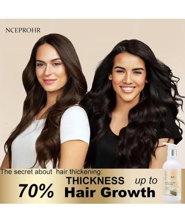 Rice Water Hair Growth Shampoo | Biotin & Rosemary Oil for Hair Loss | Natural Thickening Shampoo for All Hair Types - 10 Fl Oz - Buy Online on GoSupps.com
