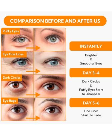 LANBENA Vitamin C Under Eye Patches - 60 Pcs Cooling Eye Masks for Dark Circles Puffiness Fine Lines & Anti-Aging - Hydrating Caffeine & Niacinamide Treatment - Buy Online on GoSupps.com