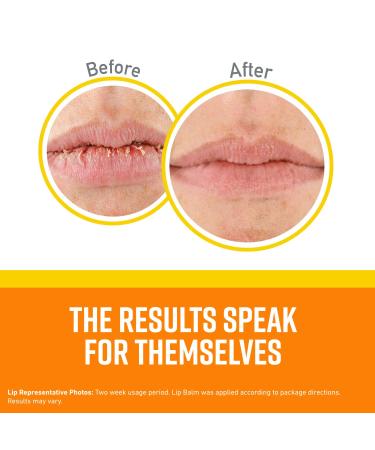 O'Keeffe's Lip Repair SPF 35 Lip Balm Stick - Pack of 3 - Buy Online on GoSupps.com