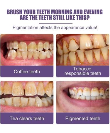 3 Days Purple Teeth Whitening Powder | Effective Tooth Whitening & Bleaching for Bright Smile | Fish Your Teeth (1PC) - Buy Online on GoSupps.com