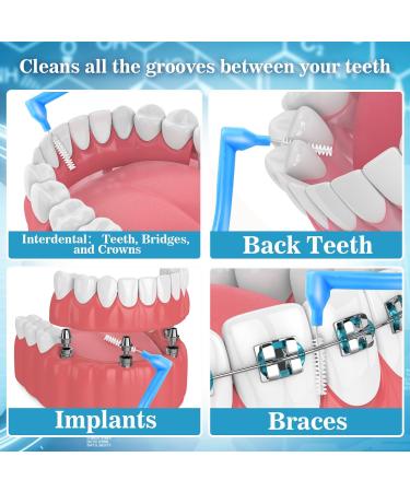Interdental Brushes for Braces - 20 Pack of Angle-Alternative Flossing Toothbrushes for Oral Dental Care - Buy Online on GoSupps.com