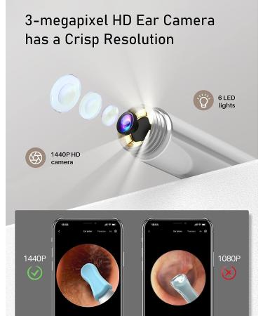 Ear Wax Removal Kit with 1440P HD Camera and 6 LED Lights | Ear Cleaner for Smaller Ears | FDA Approved Tool for iOS Android Phones - Buy Online on GoSupps.com
