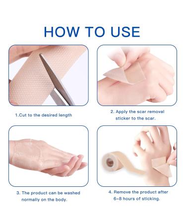 Silicone Scar Sheets 6 Pack for C-Section, Surgery, Burn, Post-Acne & Stretch Marks - 4x150cm - Buy Online on GoSupps.com