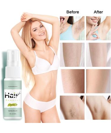  BROEYOUE 30ml hair removal spray 8-minute hair removal gently inhibits hair growth for underarms arms legs and the bikini area non-irritating hair removal products for men - Buy Online on GoSupps.com