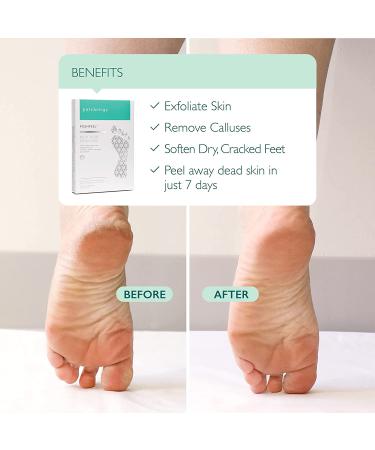 Patchology PoshPeel Pedi Cure XL - Intensive Foot Peel Mask for Calloused Feet - Deep Exfoliation Treatment for Dry Cracked Skin - Achieve Baby-soft Renewed Feet - Buy Online on GoSupps.com