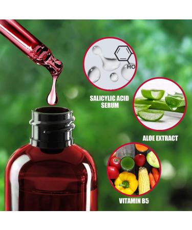 AHA 30% + BHA 2% Peeling Solution - Exfoliating Serum for Blemishes Pore Congestion & Fine Lines | 30ml International Shipping - Buy Online on GoSupps.com