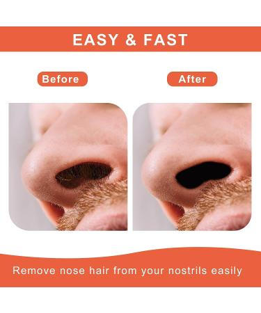 Nose Wax Kit for Men and Women - ANREACHO Nose Hair Removal Kit - 100g Wax, 20 Applicators, Ear Hair Removal - Safe, Easy, Painless Home Waxing (15-20 Uses) - Buy Online on GoSupps.com