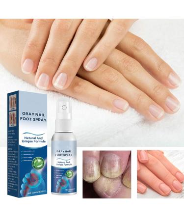 Furzero Nail Fungus & Athlete's Foot Treatment Spray - Medical Grade Anti-Itch Relief (3pcs) - Buy Online on GoSupps.com