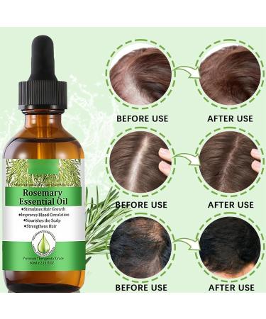 Rosemary Hair Oil(60ml) Rosemary Oil for Hair Growth Diluted Rosemary Essential Oils for Hair Loss & Skin Care Strengthens Hair Nourishes Scalp Hair Loss Improve Oil for Women and Men - Buy Online on GoSupps.com