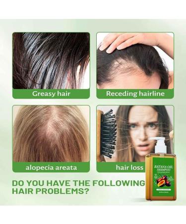 Batana Oil Shampoo Shampoo De Batana Shampoo De Batana Para La Caida Del Cabello Rosemary Oil Shampoo Champu De Batana Batana Oil & Rosemary Shampoo Batana Oil Shampoo with Rosemary Extract (600ml) - Buy Online on GoSupps.com