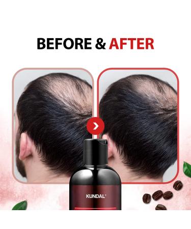 KUNDAL White Musk Anti-Hair Loss Caffeine Scalp Care Shampoo x2 - 300ml - Buy Online on GoSupps.com