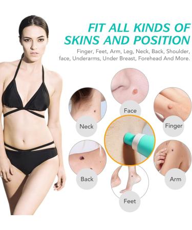 2 in 1 Skin Tag Remover Pen Kit - Painless Micro Skin Tags & Moles Removal for All Body Parts - Buy Online on GoSupps.com