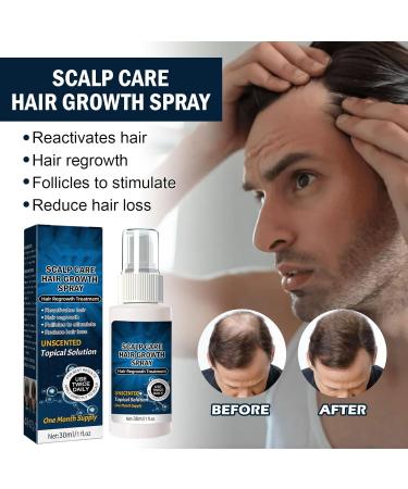 Extra Strength Hair Regrowth for Men's Hair Loss Men's Hair Growth Serum for Beard Care Serum - Buy Online on GoSupps.com
