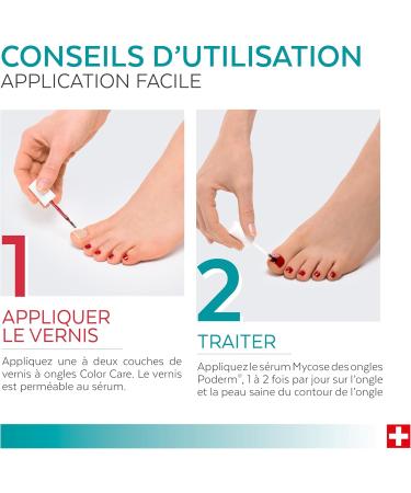 PODERM S rum Mycose des Ongles + Vernis Ongles Rouge Allure Antifongique R pare & Camoufle les Ongles Jaunis pour des Ongles Visiblement Plus Sains | D velopp par une Podologue | Swiss Made Serum Mycose + Rouge Allure - Buy Online on GoSupps.com