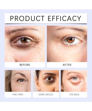 XINRAN Eye cream with beef tallow coffee against dark circles longlasting moisture care gentle care for radiant eyes eye cream with beef tallow from pastured animals for tired eyes 4 pieces - Buy Online on GoSupps.com