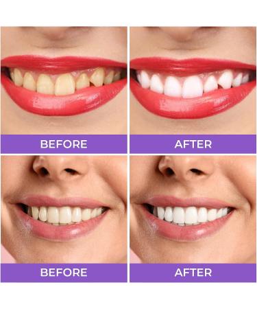 Purple Teeth Whitening: Advanced Stain Removal & Whitening Tooth Foam (50ml) - Buy Online on GoSupps.com
