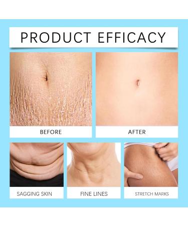 Skin Firming Cream Body Firming Cream for Loose Skin Skin Tightening Cream for Stomach Belly Firming Cream for Women&Men Skin Firming Lotion for Cellulite and Stretch Marks Lifting Moisturizing - Buy Online on GoSupps.com