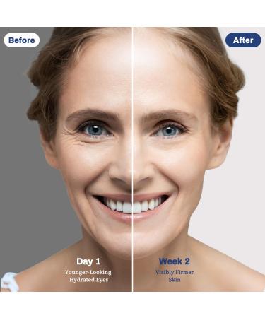 Sylvaseren Eye Repair Cream for Dark Circles and Puffiness Wrinkles Under Eye Cream anti aging for Men & Women with Aloe Jojoba Oil and Centella Asiatica Unscented Daily Wrinkle Cream 1.06 oz - Buy Online on GoSupps.com