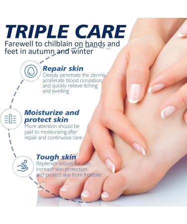 Deep-nourishing crack frostbite and cracking moisturizer cracking and frostbite repair cream for cracked skin for dry and cracked heels Removes calluses - Buy Online on GoSupps.com