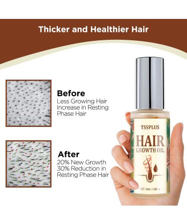 Hair Growth Serum & Oil for Thicker, Healthier Hair | Biotin, Castor Oil, Rosemary | Hair Loss Treatment - Buy Online on GoSupps.com