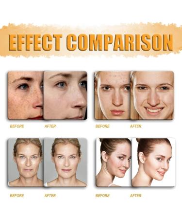 KQLULU 2Pcs Lemon Turmeric Kojic Acid Soap Bar Turmeric Brightening Soap Turmeric Moisturizing Soap Organic Turmeric Soap Bar For Face & Body Smooth Skin Fades Freckles - Buy Online on GoSupps.com