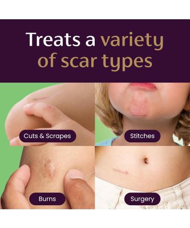 Mederma Scar Gel for Kids 0.70 Oz - Pediatrician Recommended, Reduces Scars, Kid Friendly Grape Scent - Buy Now! - Buy Online on GoSupps.com