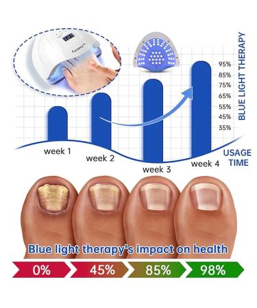 Furzero Purenail Laser Therapy Device - Effective Nail Fungus Treatment Light Therapy Solution for Healthy Nails - Buy Online on GoSupps.com
